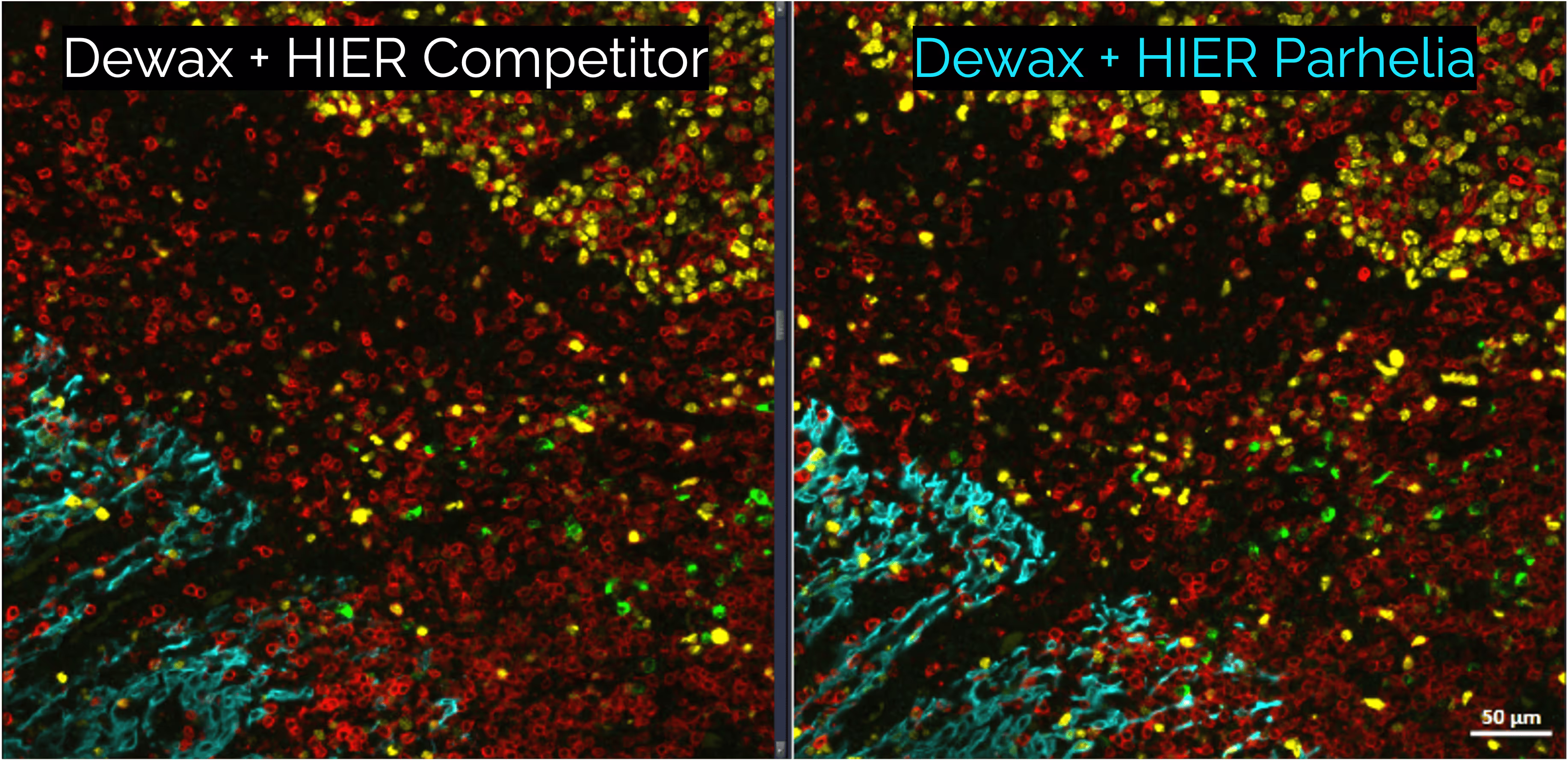 Antigen Retrieval on the Parhelia Spatial Station