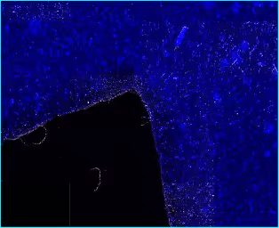 Parhelia Dewax Reagent: Human brain FFPE, Parhelia Dewax. Complete dewaxing removes autofluorescence