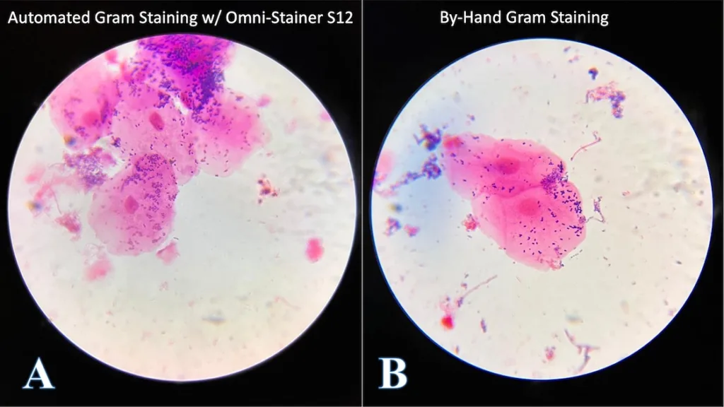 Automated Gram Staining on Omni-Stainer compared to by-hand
