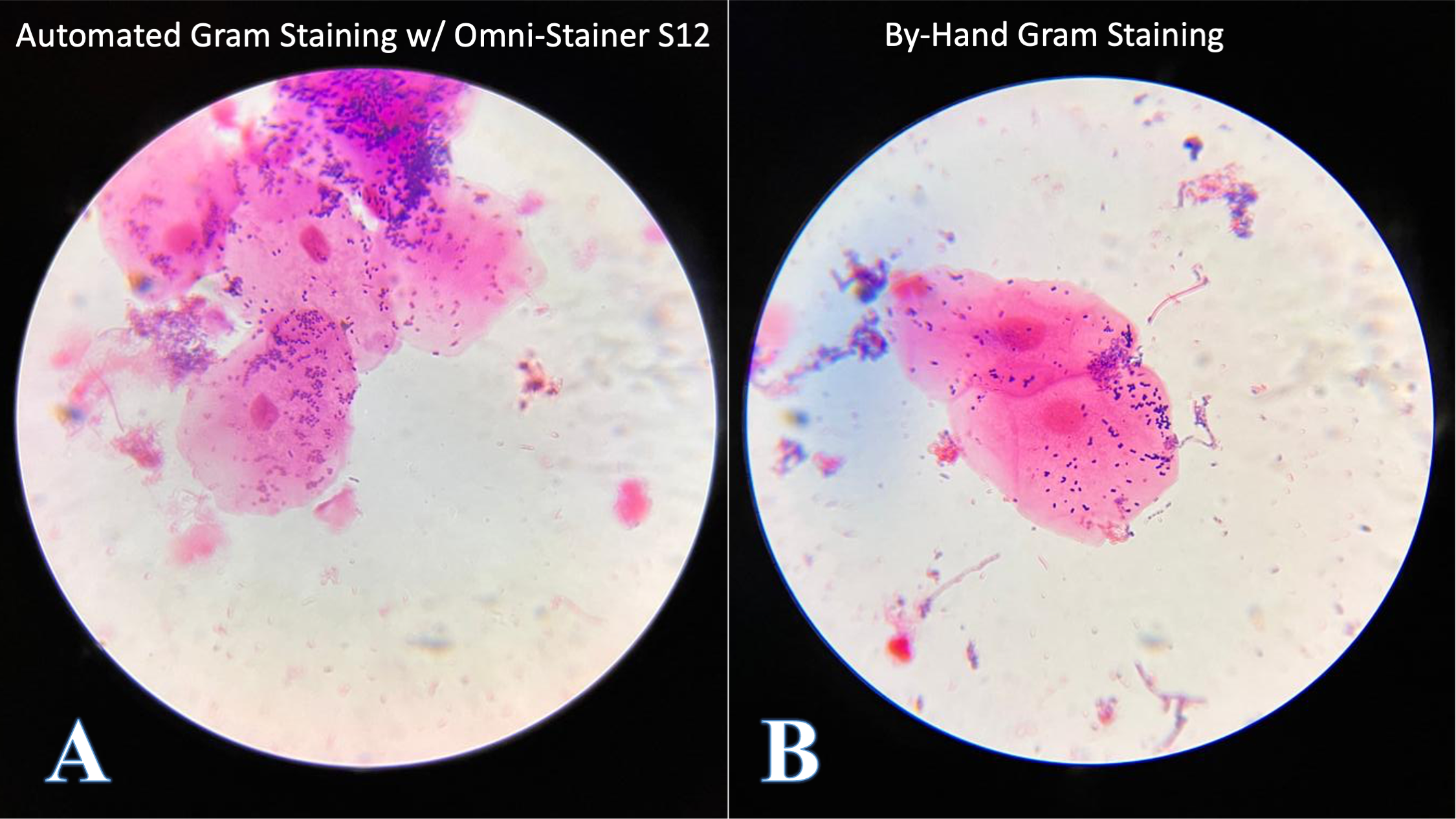 side-by-side-larger-no-title-microscope-gram-dental